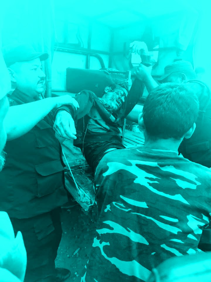 साइकलबाट लडेर गम्भीर घाइते भएका डोबालको मृत्यु